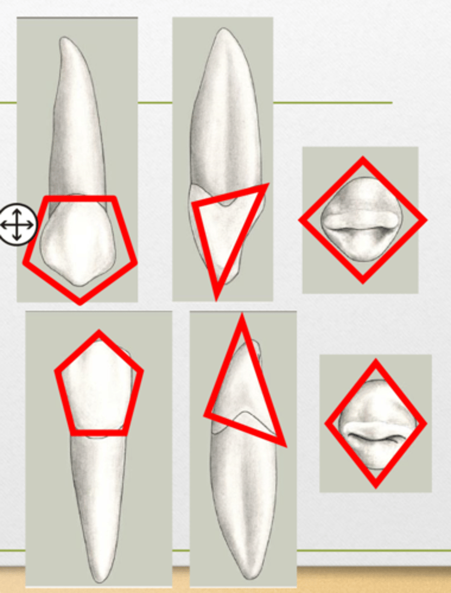 <p>Pentagonal</p><p>Triangular</p><p>Diamond</p>