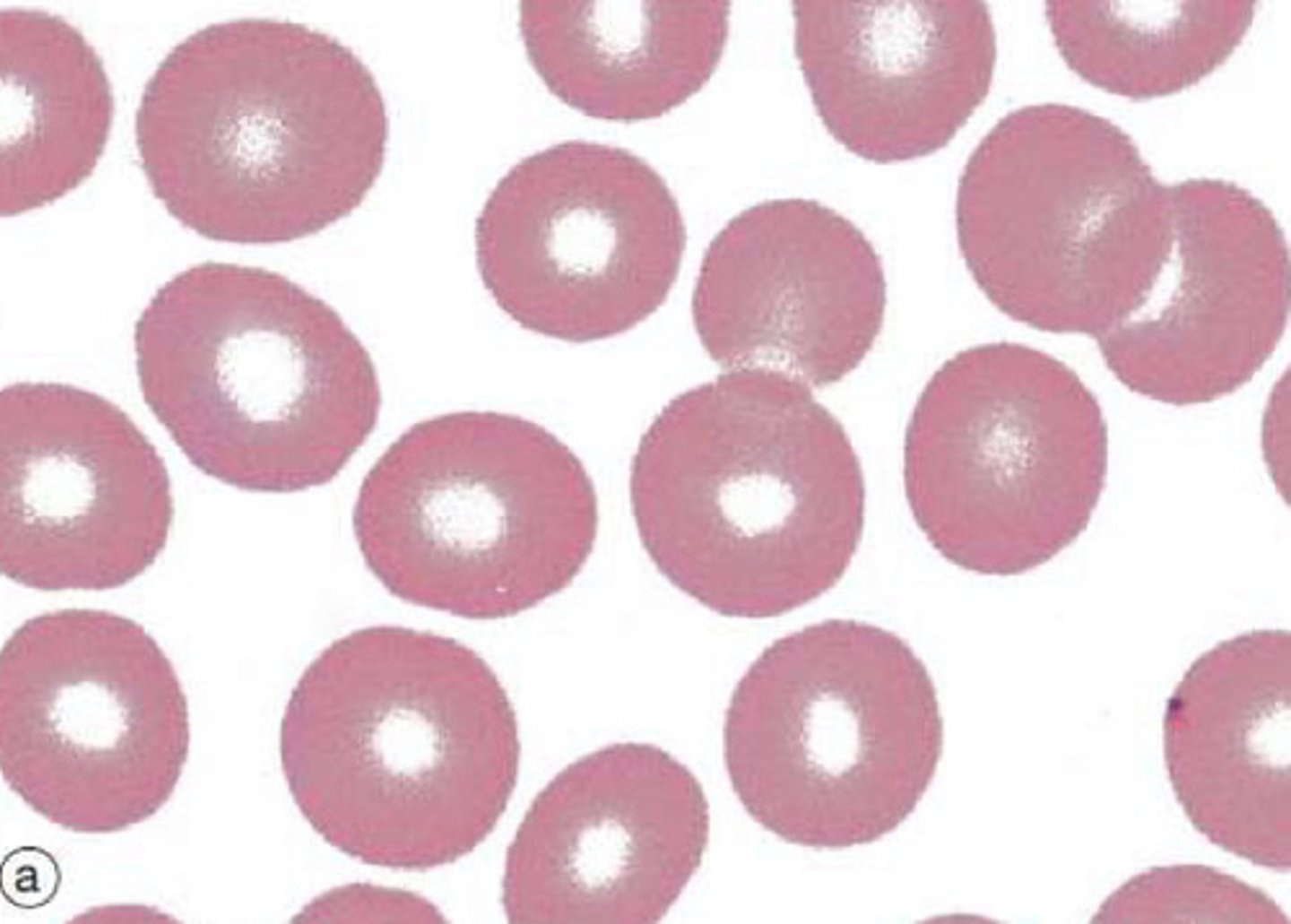 <p>Anucleate cells densely filled with haemoglobin - have no organelles</p><p>- Flexible, biconcave discs with a diameter of ~7.2uM (x2 diameter of narrowest capillaries)</p><p>- Large surface area for gaseous exchange for delivering oxygen to tissues and returning carbon dioxide to lungs</p>