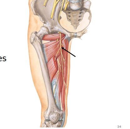 <p>Obturator nerve</p>