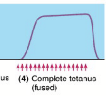<p>Complete tetanus</p>