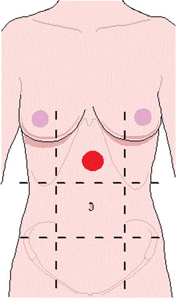 <p>-Location:</p><p>Abdominal wall (anterior)</p><p>-Description:</p><p>One of nine regions of abdominal cavity</p><p>Upper median region (flanked by right and left hypochondriac regions)</p><p>Contents include suprarenal glands and parts of stomach, large intestine, liver and gallbladder, and pancreas</p>