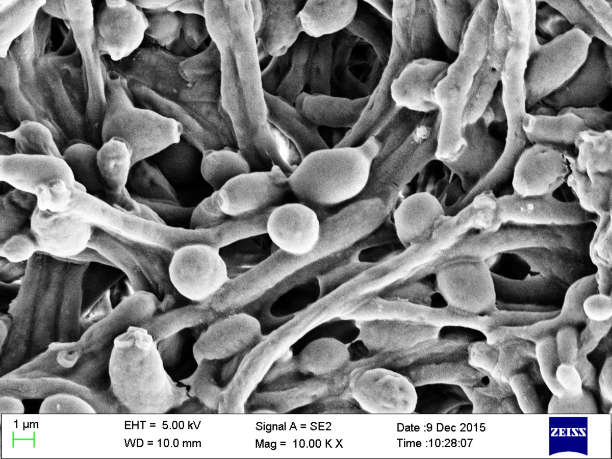 <p>What type of media does Candida grow on? Yeast or mold?</p>