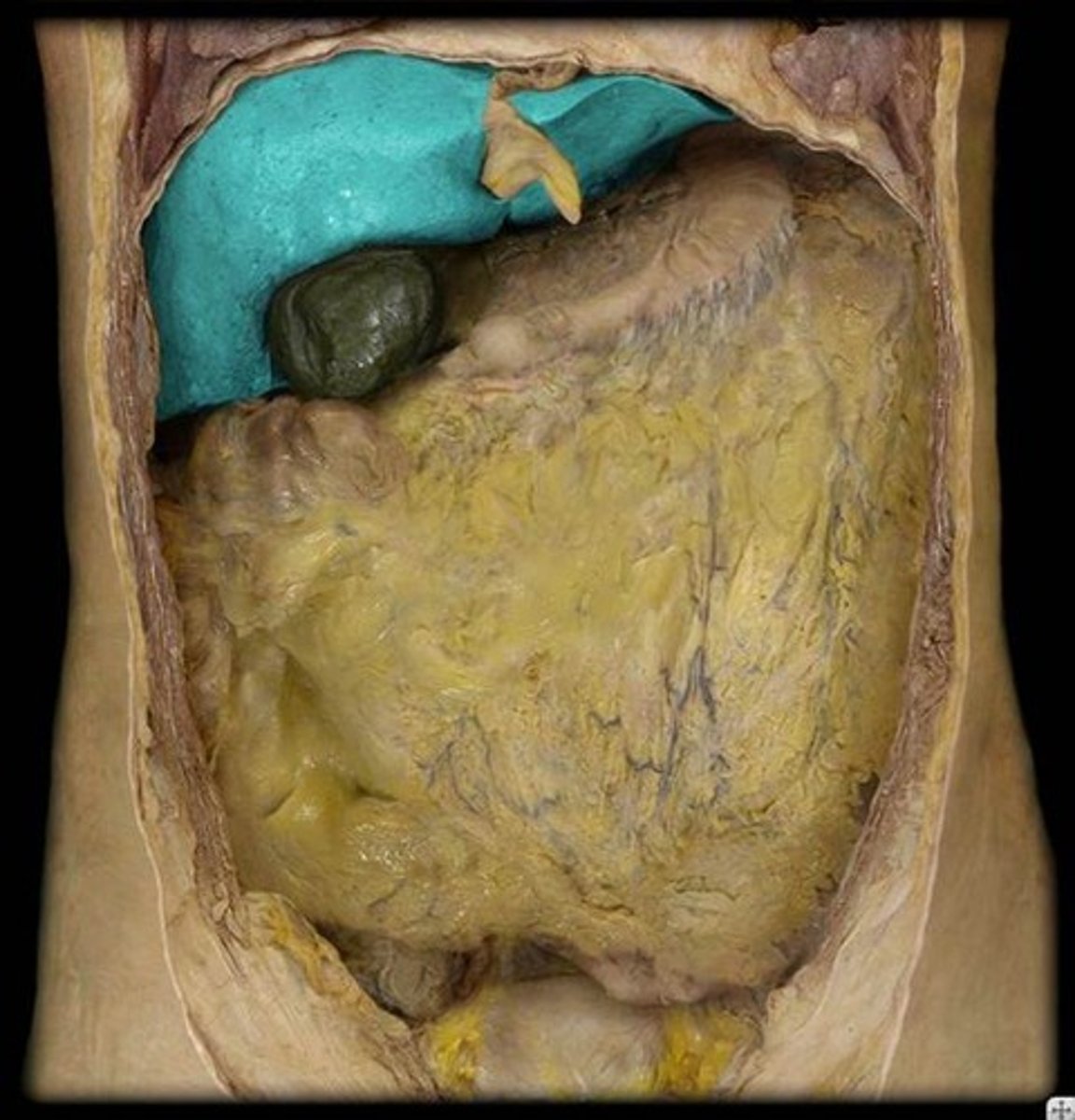 <p>Identify this accessory digestive organ.</p>