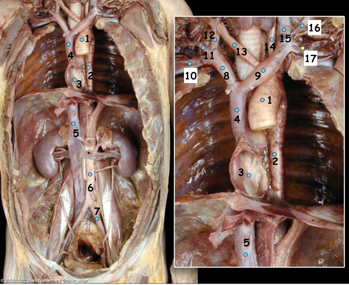 <p>What is number 3?</p>