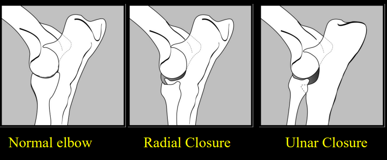 <ul><li><p><strong>Distal Ulnar</strong></p><ul><li><p><strong>Short ulna </strong></p></li><li><p>Radius may bow</p></li><li><p>Distal radius is subluxated craniomedially from the radial carpal bone</p></li><li><p>foot deviates laterally</p></li><li><p><strong>wide humero-ulnar joint</strong></p></li><li><p><strong>common </strong></p></li></ul></li><li><p><strong>Distal Radial</strong></p><ul><li><p><strong>Short radius </strong></p></li><li><p>Wide radiocarpal and radiohumeral joint space</p></li><li><p>elbow/carpus degeneration</p></li></ul></li></ul><p></p>