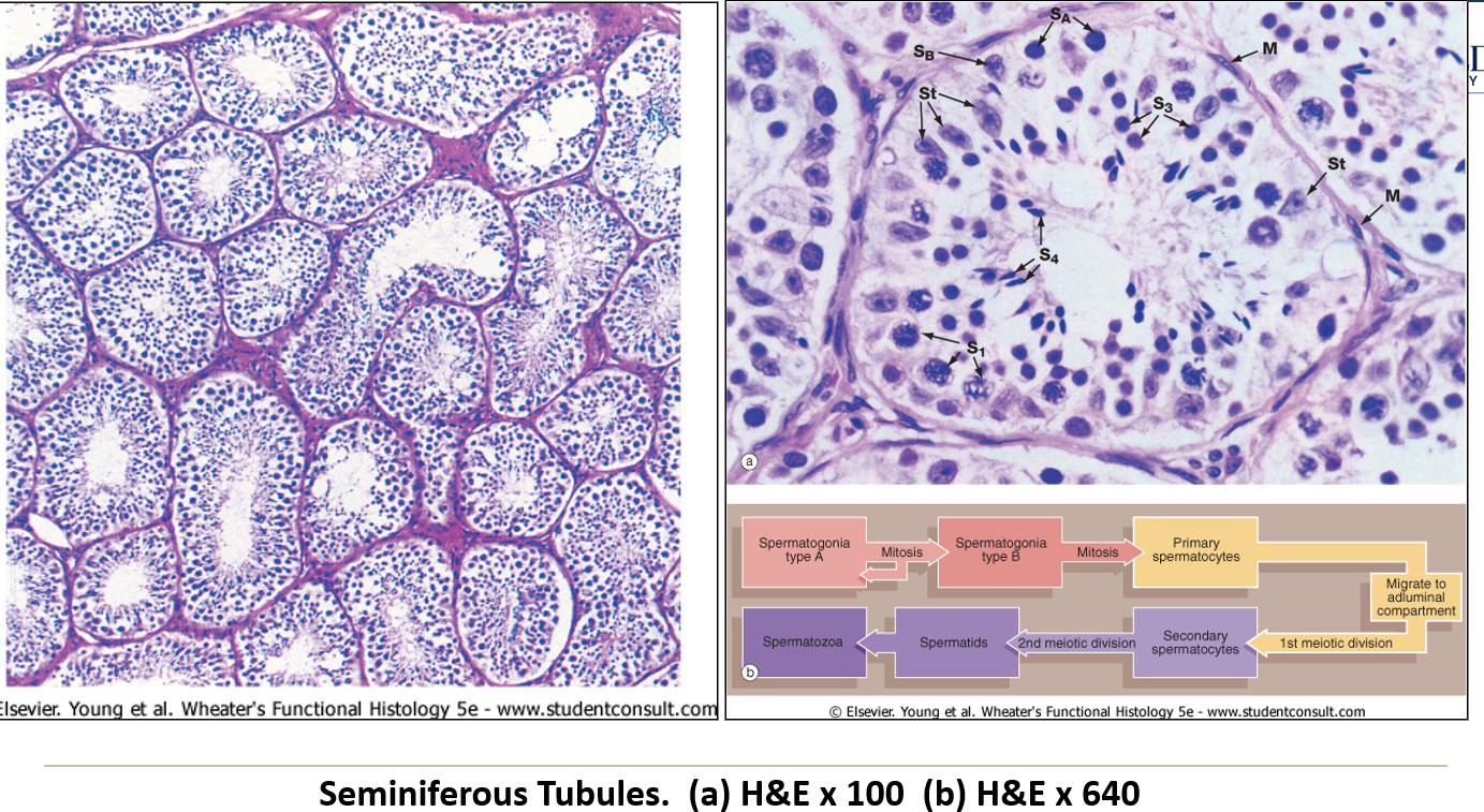 <p>A <strong>thick basement membrane</strong> with <strong>myoid cells</strong>, which <strong>thicken with age or disease</strong>.</p>