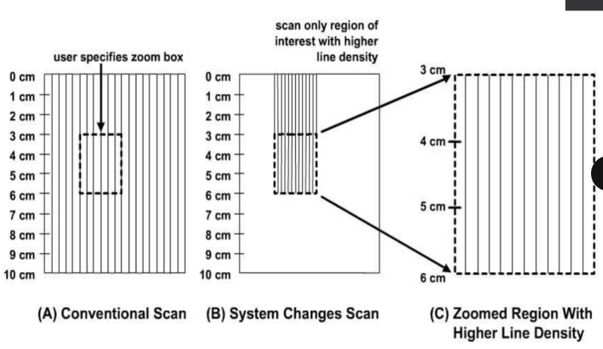 <p>(1) operator identifies the ROI to be magnified</p><p>(2) the system rescans only the ROI</p><p>(3) <strong><em>new data </em></strong>is written into the scan converter</p>