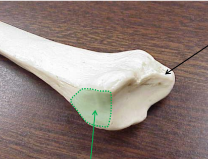 <p>What is the black arrow pointing to? </p>