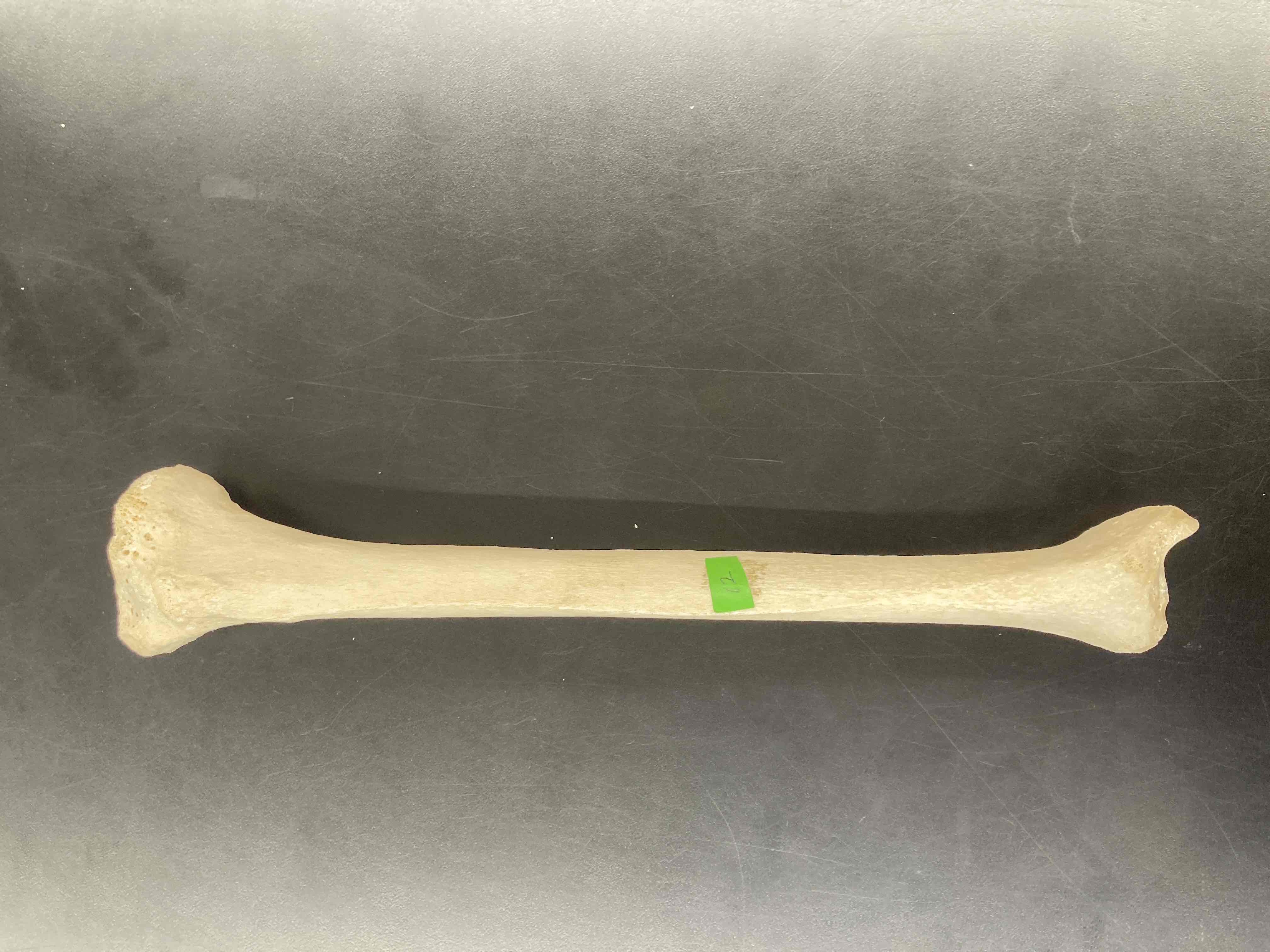 <p>What is this bone called?</p>