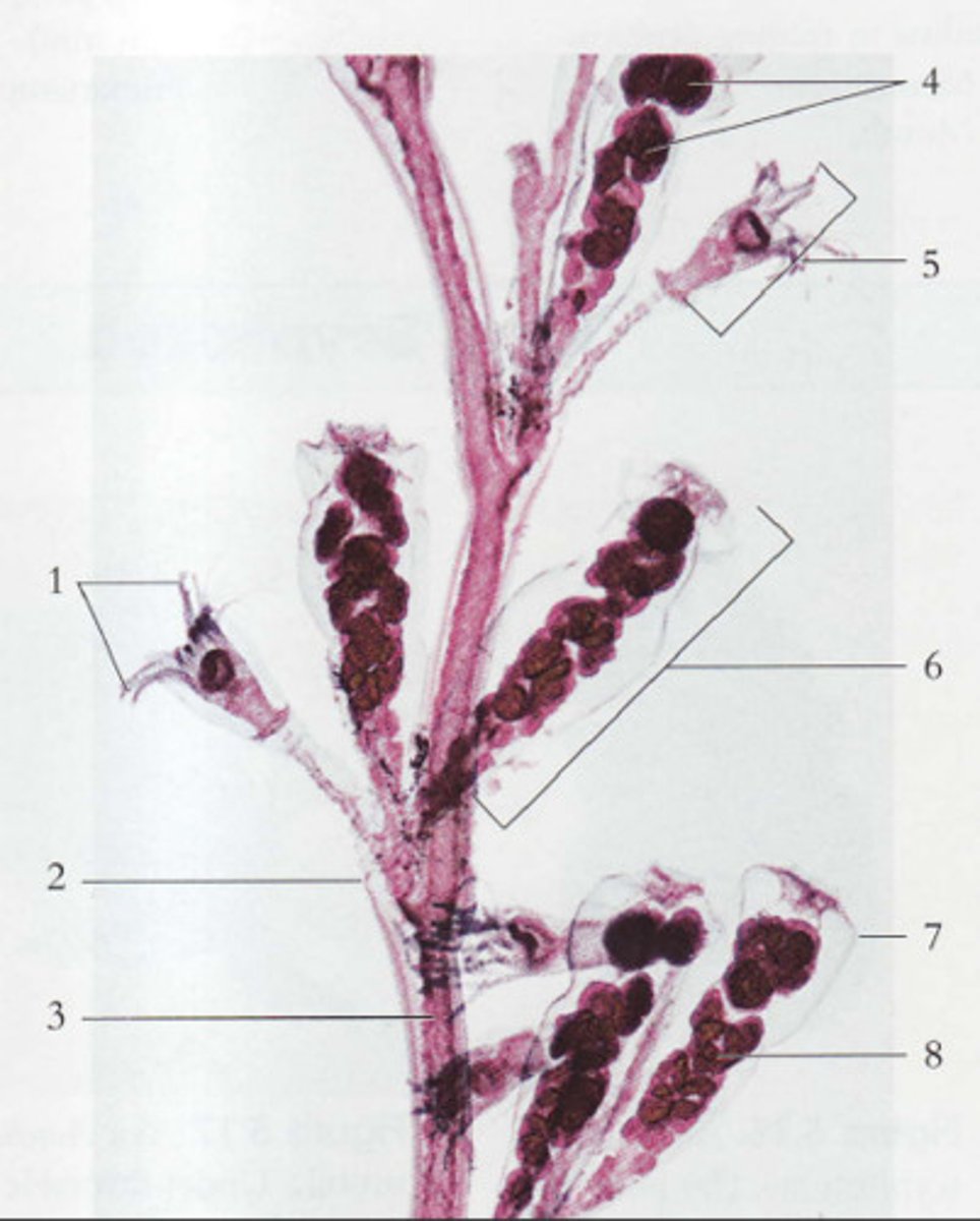 <p>What structure is being pointed to? (3)</p>