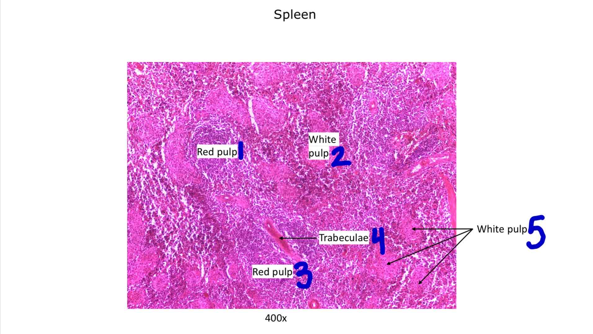<ol><li><p>Red pulp</p></li><li><p>White pulp</p></li><li><p>Red pulp</p></li><li><p>Trabeculae</p></li><li><p>White pulp</p></li></ol>