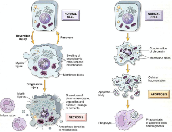 
1. __Necrosis__

Cells swell and explode. Cell contents spill out. Frequently leads to inflammation.

\

2. __Apoptosis__

Cells shrink and fragment. Apoptotic bodies are phagocytosed. No inflammation. 