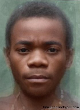 <p>Identify this Phenotype</p>