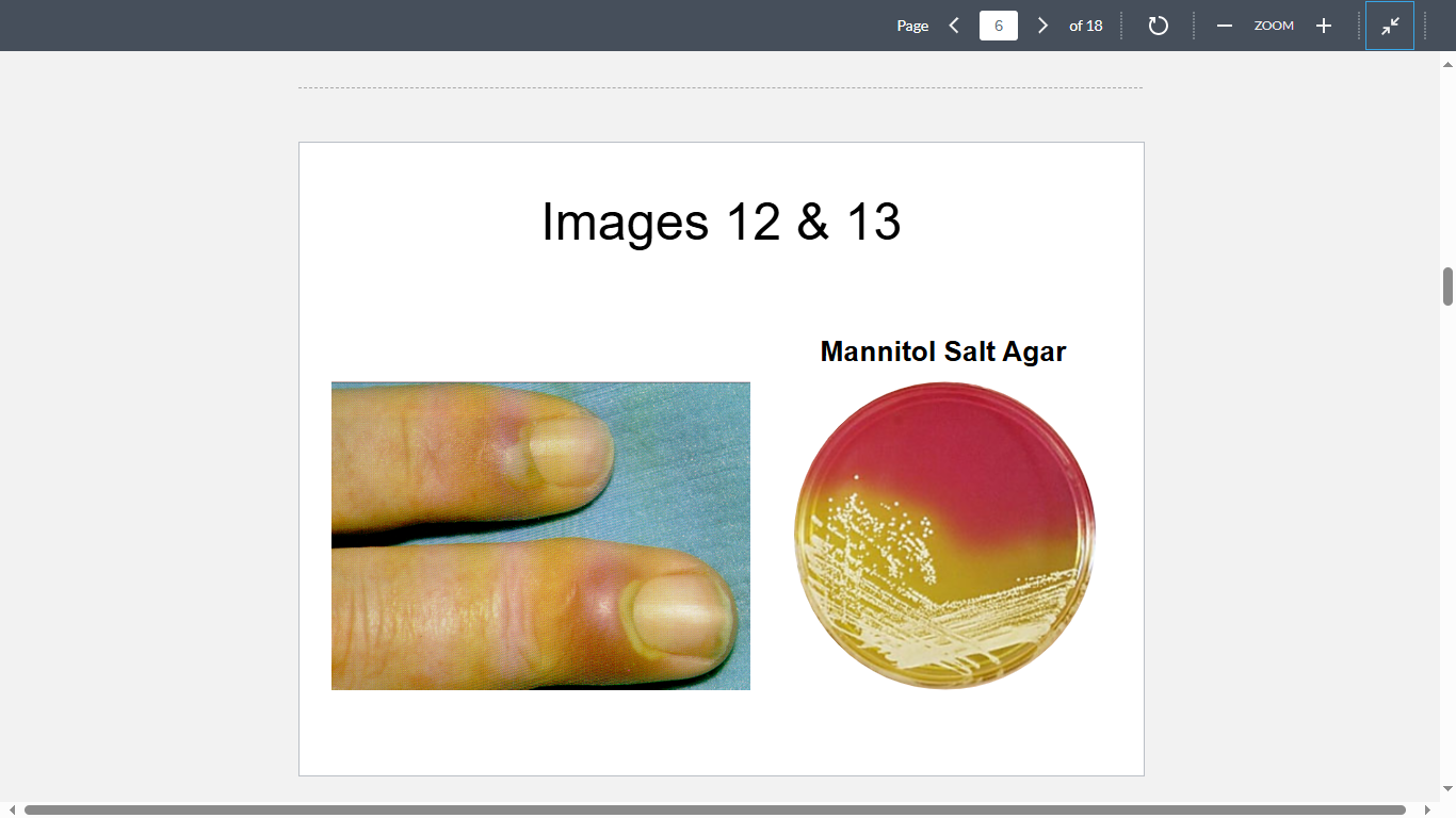 <p>A 30-year-old man presents with the following nail condition (Image 12). Culture of the drained pus is shown in Image 13. Clumping test is positive. What is the most likely cause?</p>