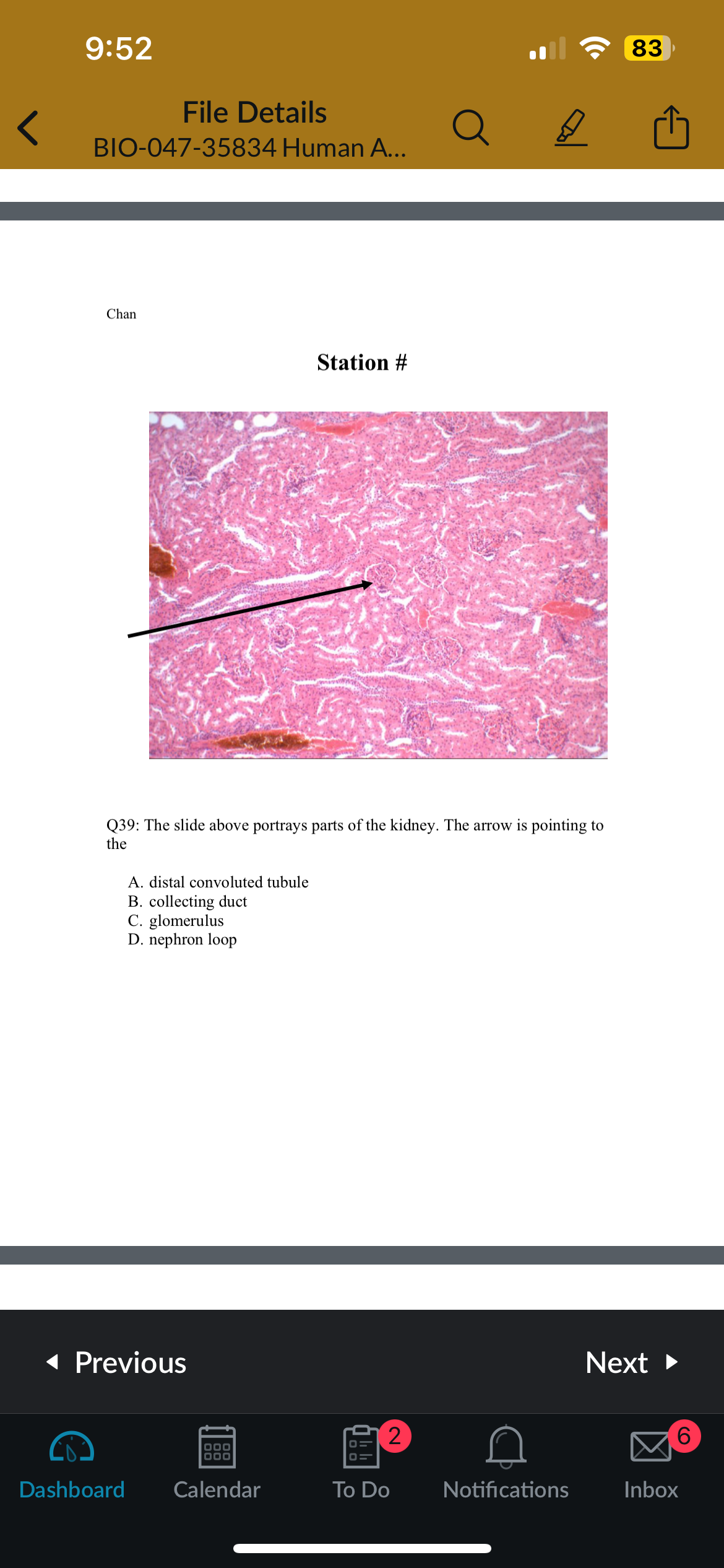 <p>Q39: The slide above portrays parts of the kidney. The arrow is pointing to the</p>