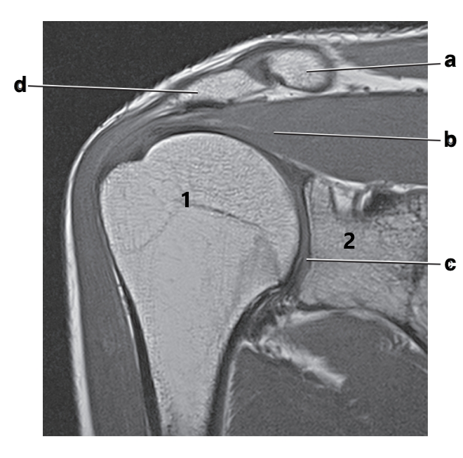 <p>What is letter b?</p>