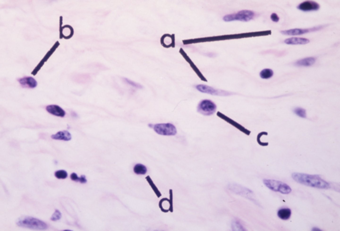 <p>what cell type is letter c?</p>