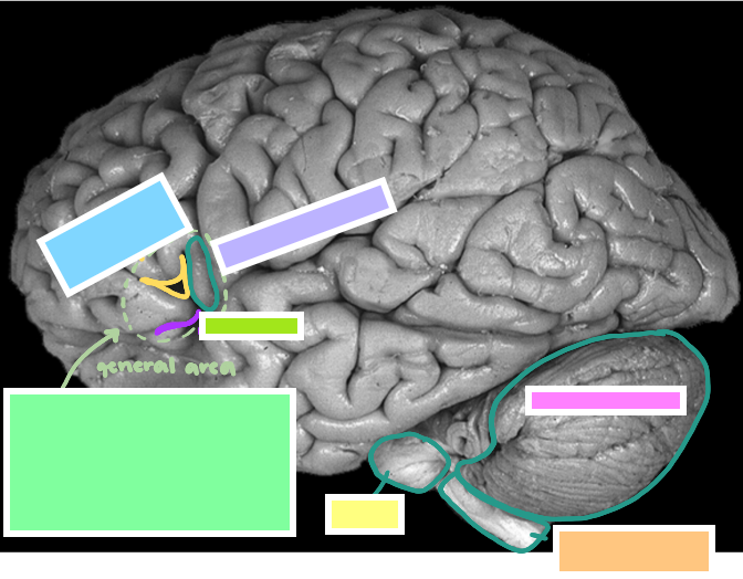 <p>What is the purple box?</p>