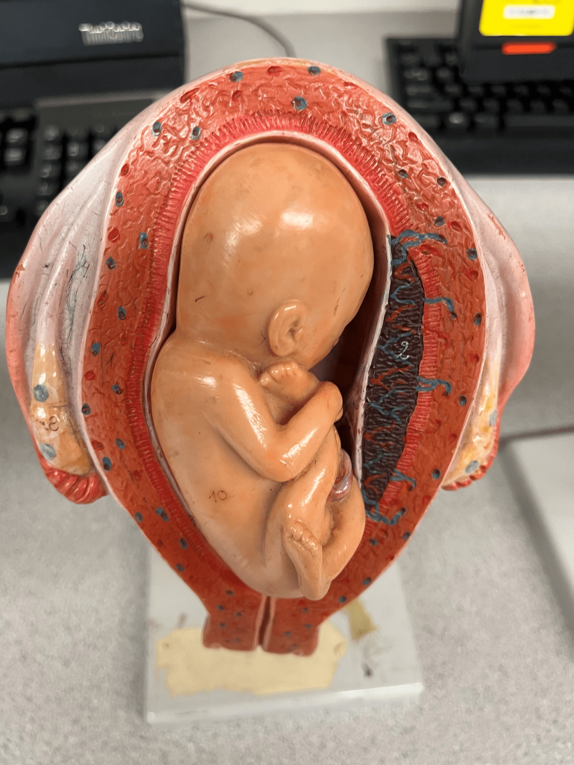 • Model of the developing fetus in the uterus.

• The position in which the feet face downwards.