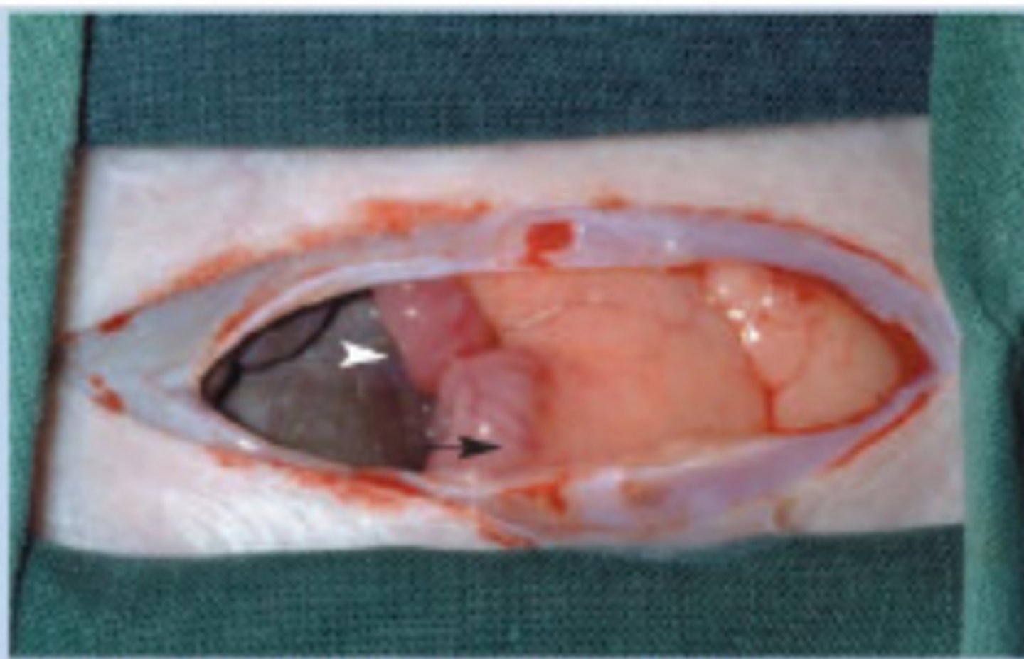 <p>What structure tends to be apparently visible when you open the abdomen for an ovariohysterectomy in rabbits?</p>
