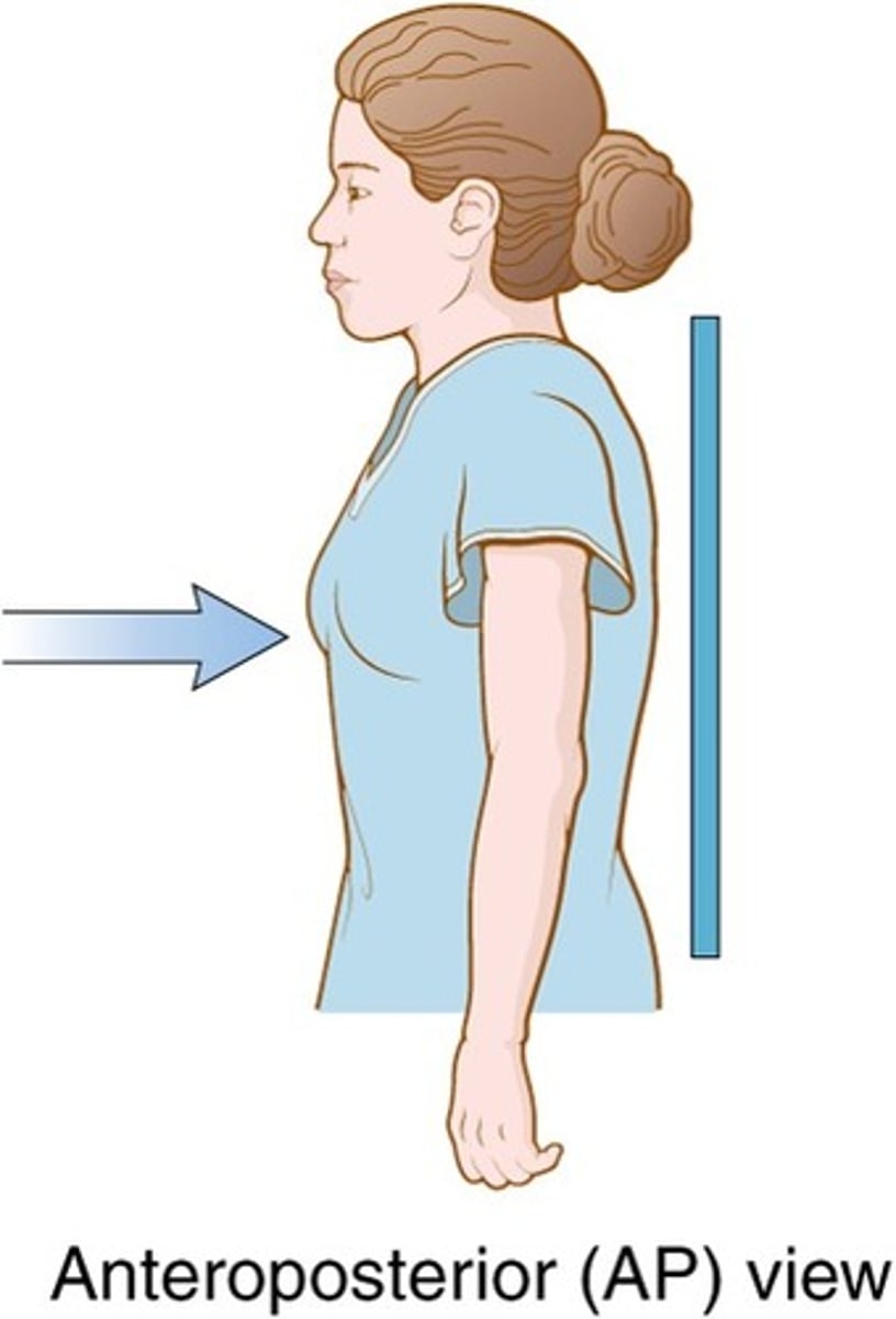 <p>Anteroposterior; entering anteriorly, exiting posterior</p>