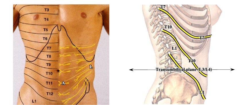 <p>-skin of anterior abdominal wall supplied by anterior (A) and lateral (L) cutaneous branches of ventral rami of spinal nerves <strong>T7 through L1</strong></p><p>-dermatome T10 at level of umbilicus</p><p>-downward trajectory of ventral rami of thoracic and lumbar spinal nerves explains why T10 dermatome includes the umbilicus yet the umbilicus is considerably inferior to T10 vertebrae and the transumbilical plane is at vertebral level L3/L4</p>