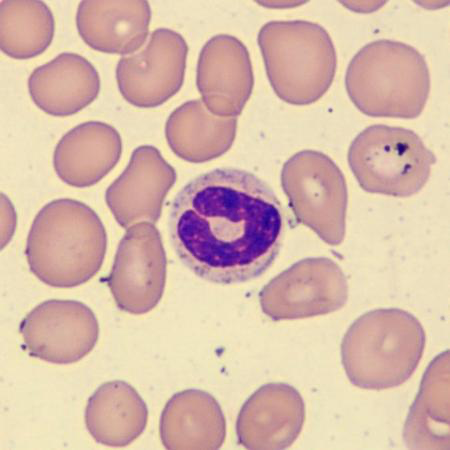 <p>What is this leukocyte?</p>