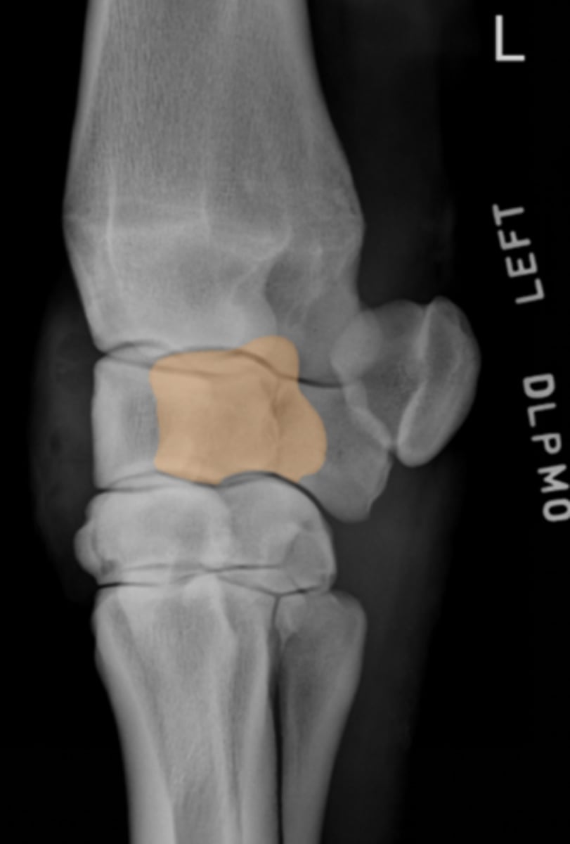 <p>What bone is highlighted?</p>