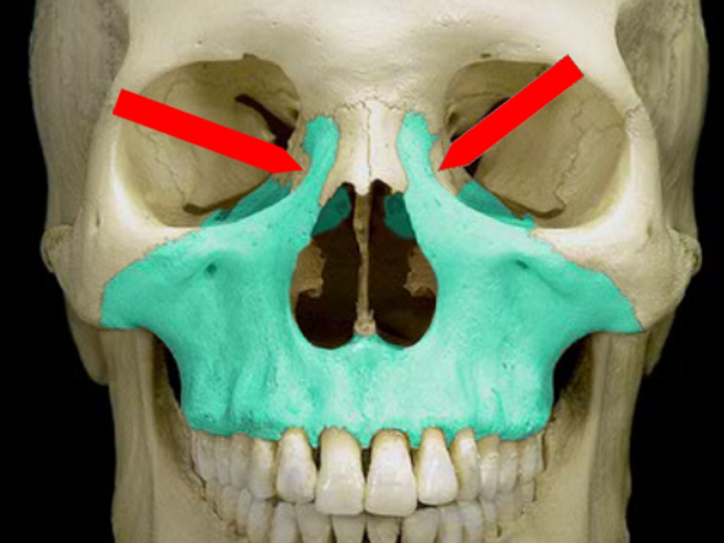 <p>The ascending part of the upper jaw; Gradually protrudes as it rises superiorly and anteriorly beside the nasal bone to articulate with the frontal bone; Influences the lateral wall of the nose; Causes the most anterior part of the cheek to be located below the inner end of the eye, inferior to the inner canthus.</p>
