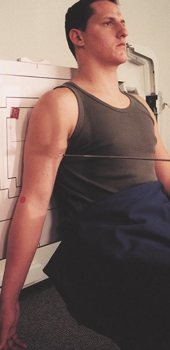 <p>AP humerus</p><ul><li><p>abduct arm slightly&nbsp;</p></li><li><p>palm foward&nbsp;</p></li></ul><p></p>