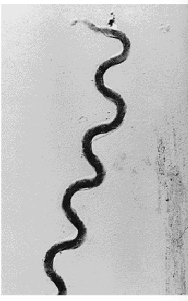 <p>Treponema pallidum, a spirochete</p>