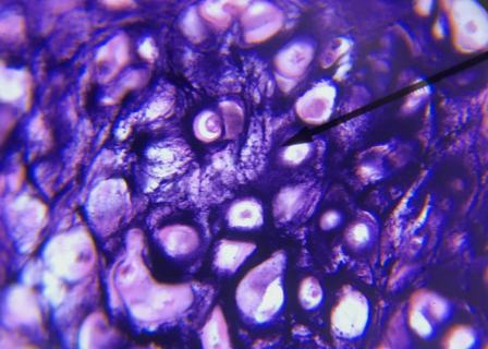 <p>what kind of cartilage is this</p>