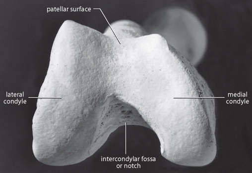 <p>much straighter and SMALL</p>
