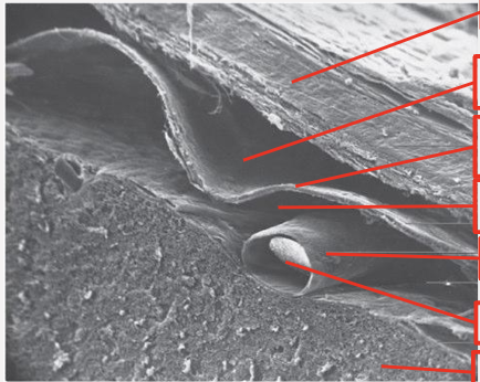 <p>Name what each layer of meninges is</p>