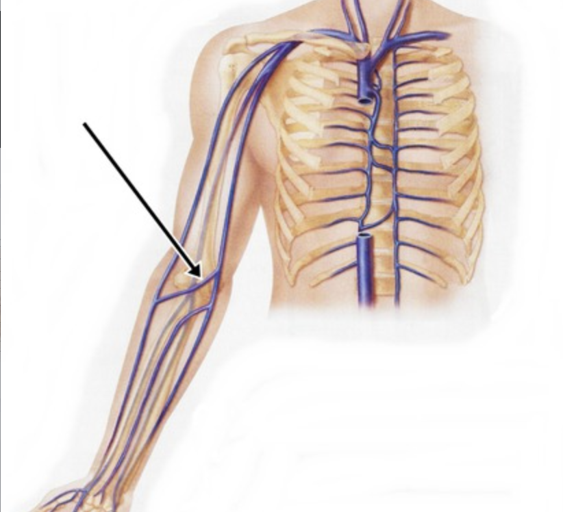 <p><span>Median cubital is the first vein of choice.</span></p>