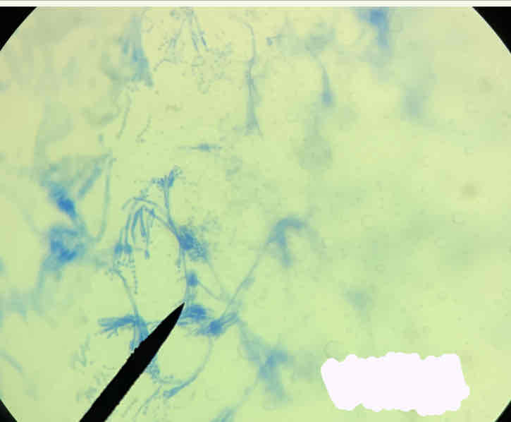 term image