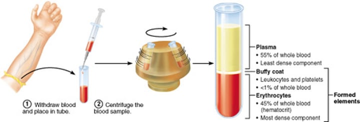 <p>After blood is drawn, a centrifuge separates the blood into three components based on density: RBCs, WBCs, and plasma</p>