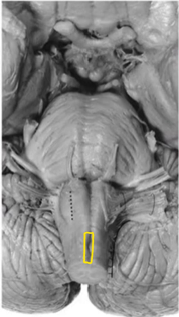 <p>ID the structure</p>