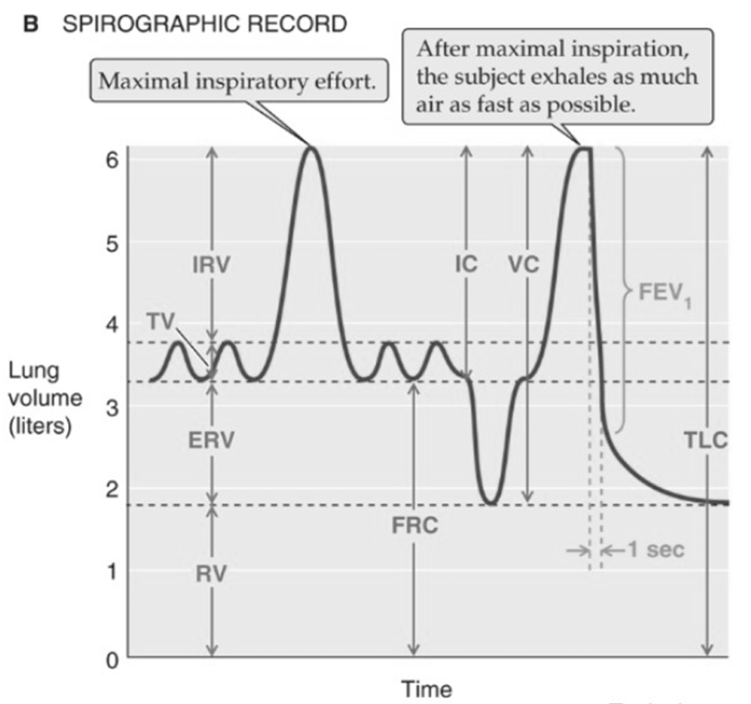 <p>TV-Tidal volume</p>