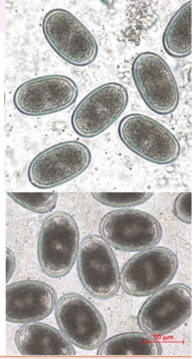 <p>• Finding eggs in the faeces (floatation methods);</p><p>• Eggs look like eggs of Ascaridia galli!!• Postmortem examination of caeca</p>