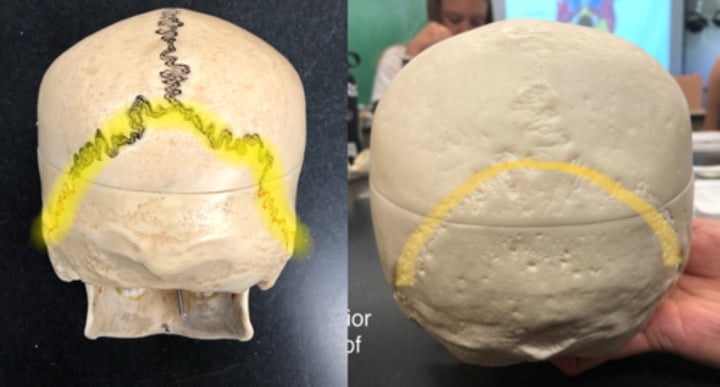 <p>Separates occipital bone and parietal bone</p>