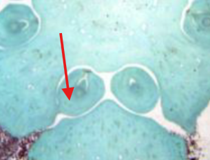 <p>What is being indicated on the Zamia Megastrobilus?</p>