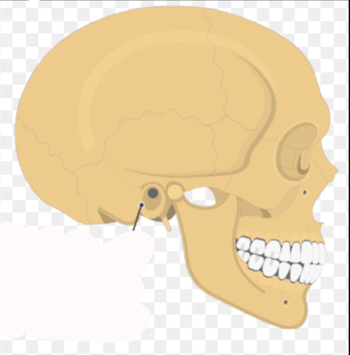 <p>Name this marking:</p>