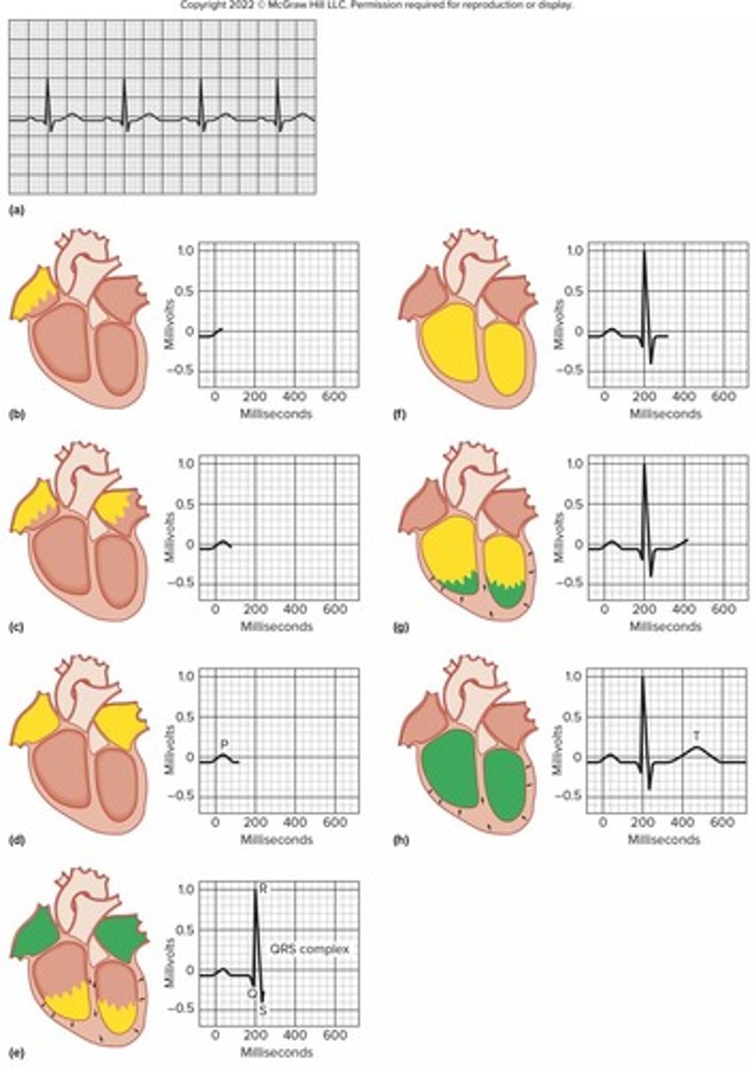 <p>Record of the electrical impulses of the heart</p>