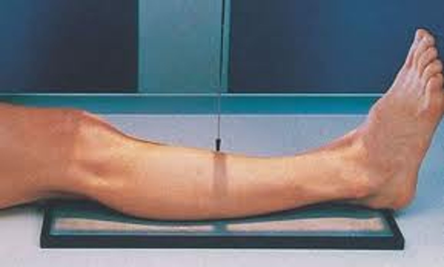 <p>-pt in supine position</p><p>-leg extended</p><p>-pelvis, knee, and leg in true AP with no rotation</p><p>-dorsiflex foot to 90 degrees to lower leg</p><p>-both ankle and knee joints are 1-2 inches</p>