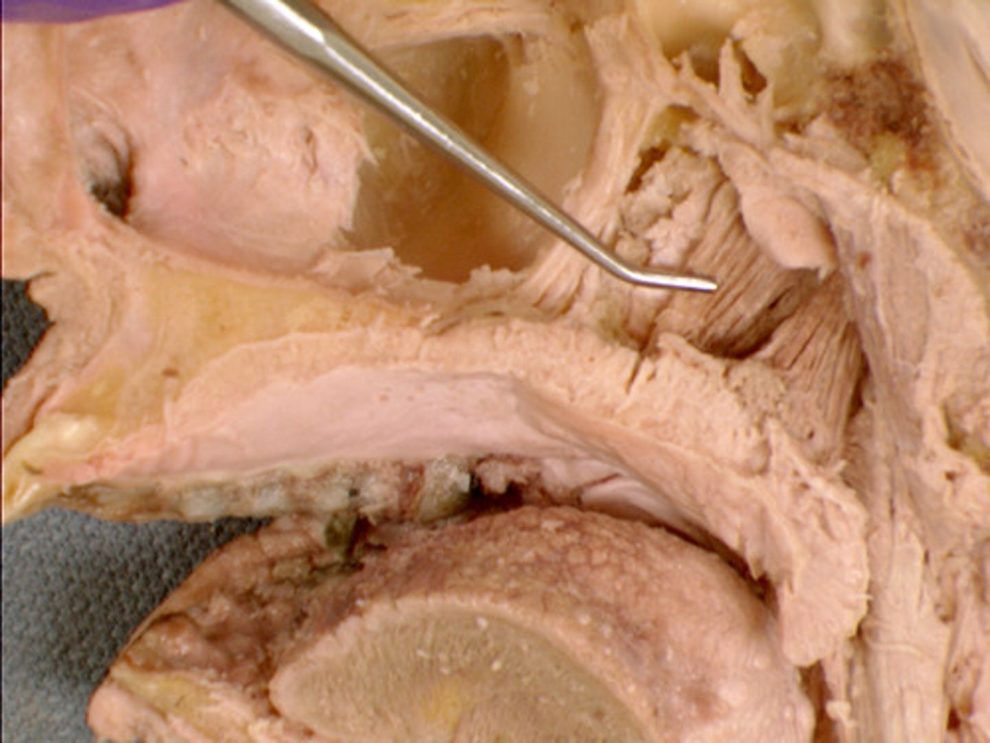<p>muscle of the soft palate that flattens/tenses the soft palate <br> -origin = scaphoid fossa<br> -insertion = central tendon (wraps around hamulus of medial pterygoid plate &amp; inserts into its own tendon)<br><br>*innervated by Mandibular Division (V3) of Trigeminal Nerve (CNV)</p>