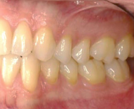 <p>CT anchoring teeth to jaws</p>