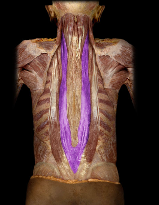 <ul><li><p>Action: Unilateral: lateral flexion of vertebral column and rotation of head to same side, Bilateral: extension of vertebral column and head, Depresses ribs</p></li><li><p>Origin: Iliac crest, Dorsal sacrum, Sacral and lumbar spinous processes, Supraspinous ligament</p></li><li><p>Insertion: Transverse processes (cervical and thoracic), ribs, and mastoid process</p></li><li><p>Innervation: Dorsal rami of spinal nerves</p></li></ul><p></p>