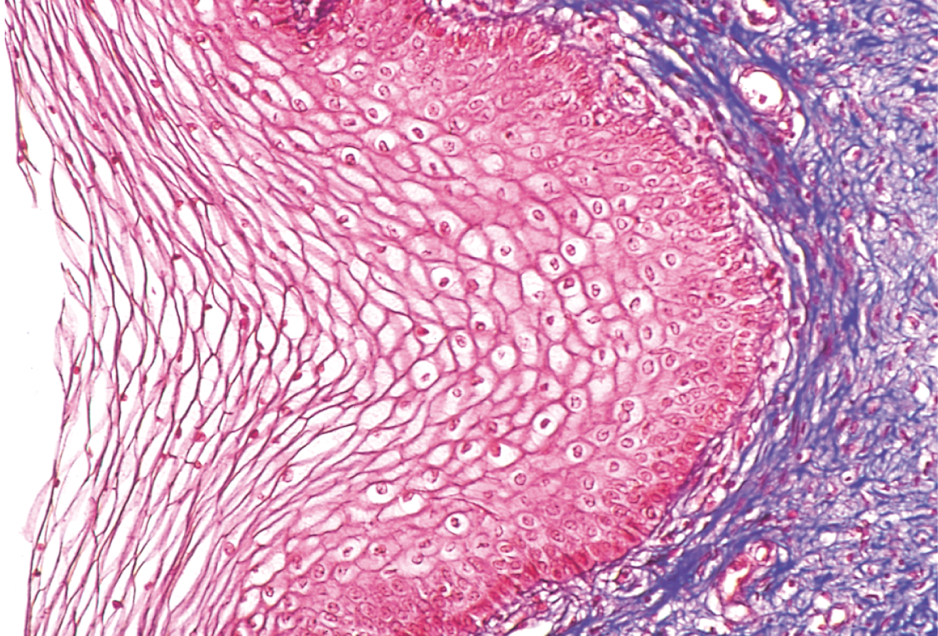 <p>Resists abrasion and penetration of pathogenic organisms; found in the tongue, esophagus, and vagina  </p>