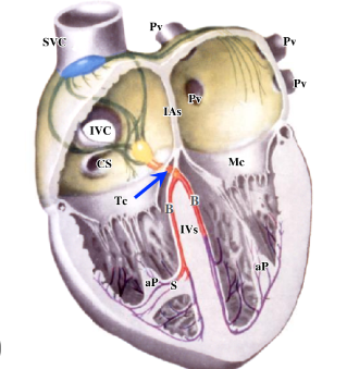 <p>-through specialized cardiac muscle pathways of both right and left atria and to the AV node</p><p>-in the AV bundle (blue arrow) through the fibrous skeleton to the muscular portion of the interventricular septum at which point it bifurcates into right and left bundle branches (red)</p>